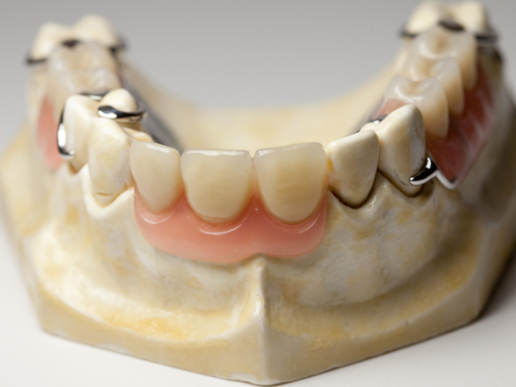 In their simplest form, dentures are artificial teeth.